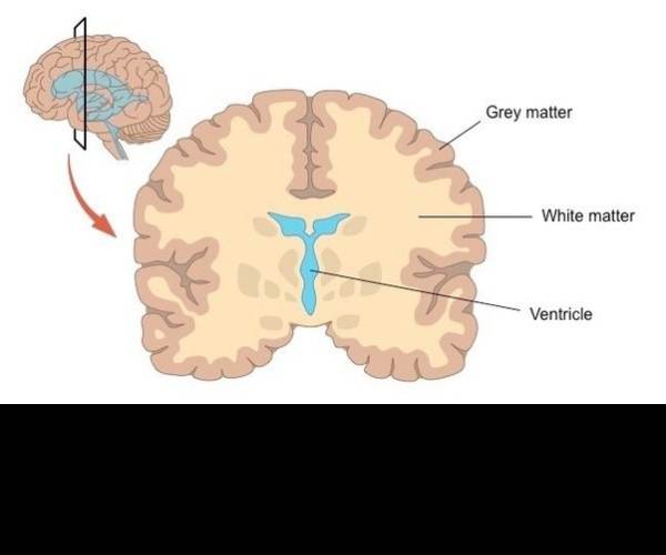 Gray Matter