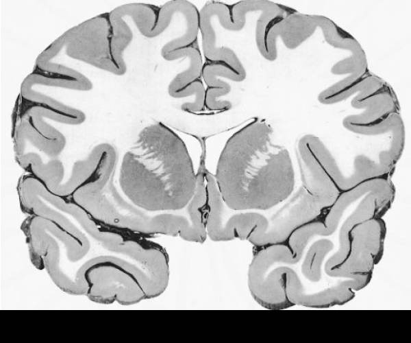 Gray Matter