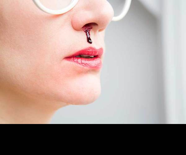 Bleed