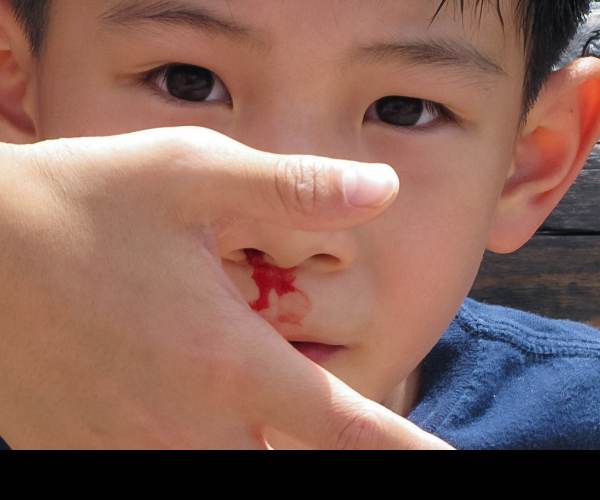 Bleed