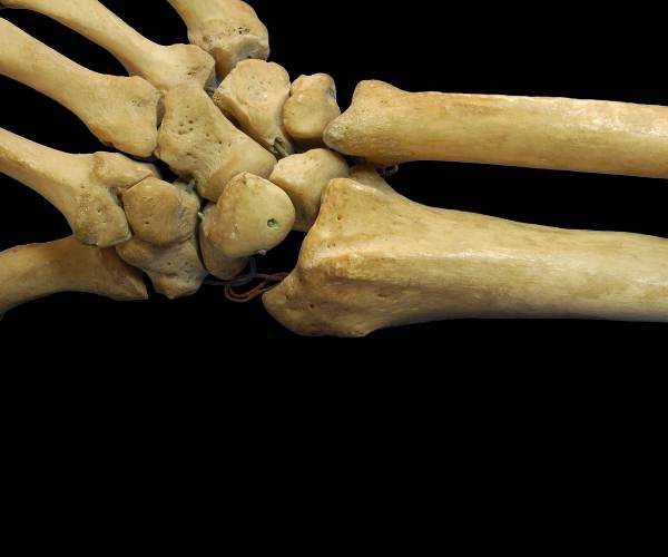 Bone