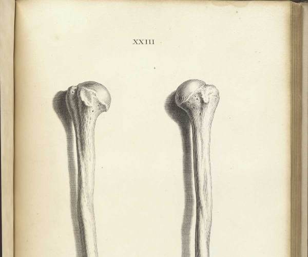 Bone