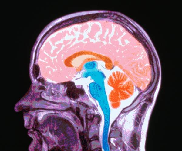 BRAIN / OUT