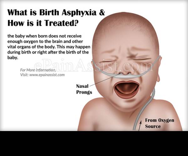 Asphyxia